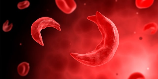Sickle cell blood shapes
