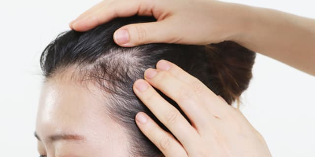 A doctor checks a patient's scalp for skin cancer