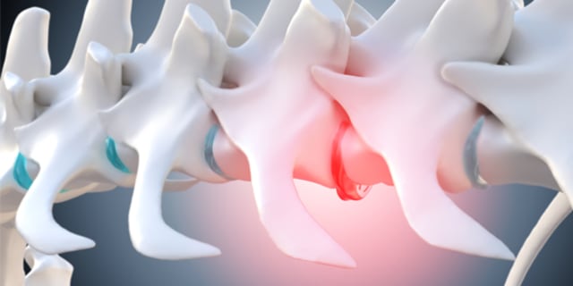 spine illustration