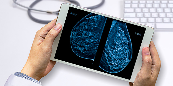 imaging of dense breast tissue