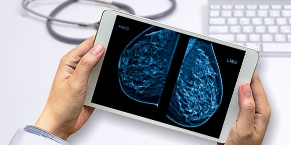 imaging of dense breast tissue