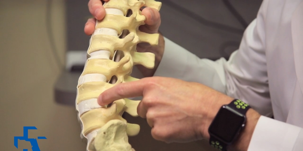 Doctor holding model of lower portion of lumbar spine, discs and nerves