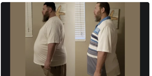 left side of photo shows an overweight man, and the right side of the photo shows him after losing a lot of weight after finding a long-term weight loss solution in bariatric surgery.