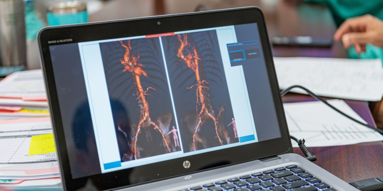 image of heart structure on a laptop screen