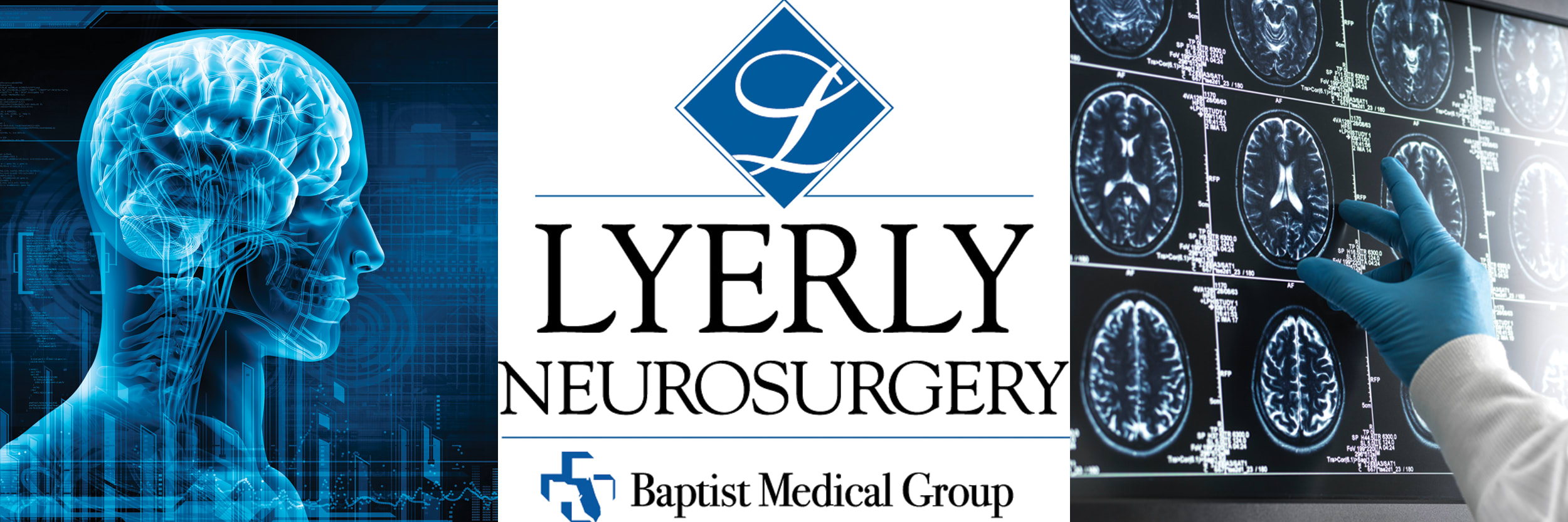 Lyerly Neurosurgery logo along with brain scans and image of a brain inside a head