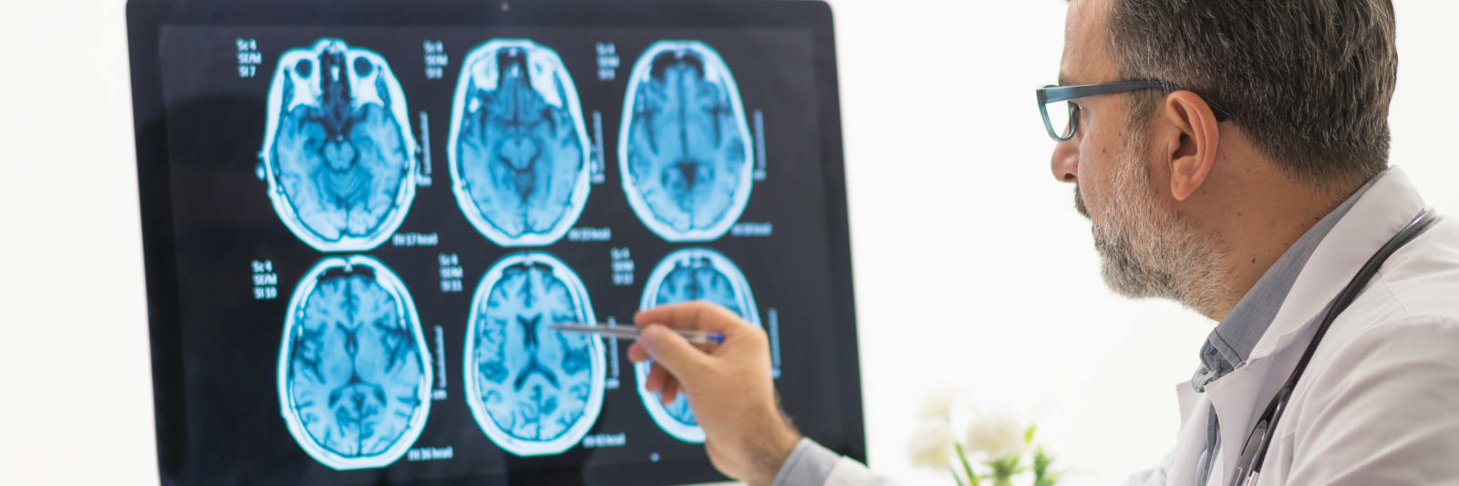 male doctor examining brain MRI