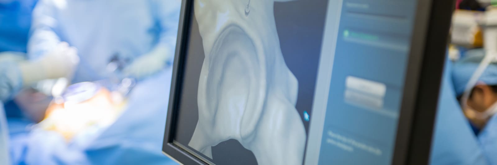 close up image of screen with surgeons in the background during surgery
