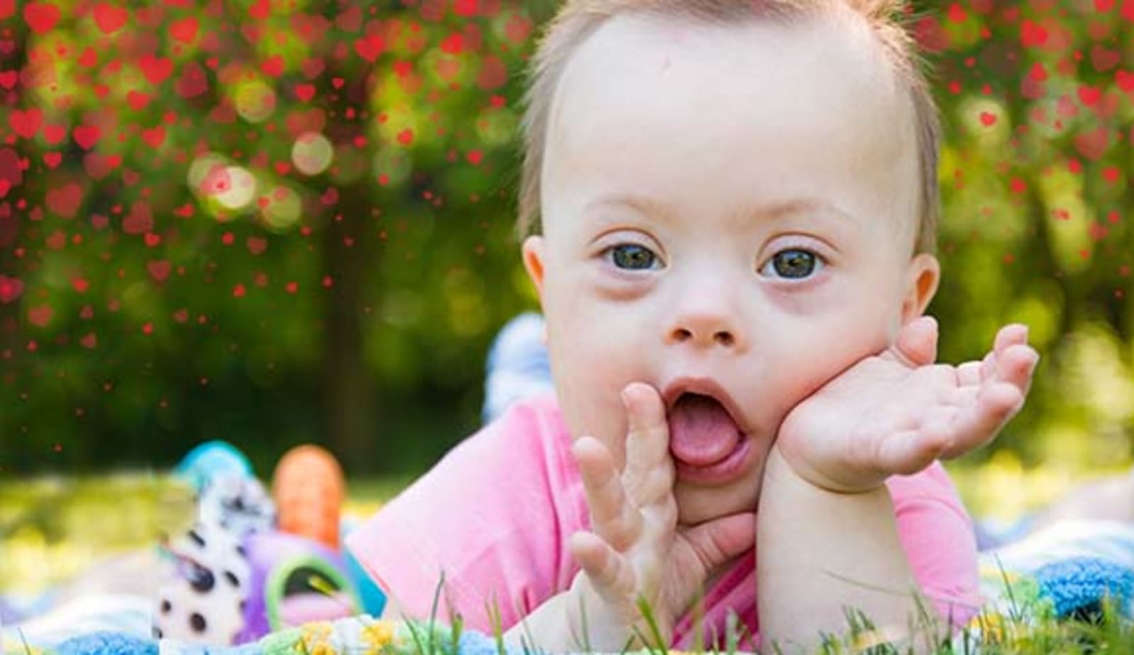 baby with Down syndrome laying on a mat the grass with red hearts overlayed on the image