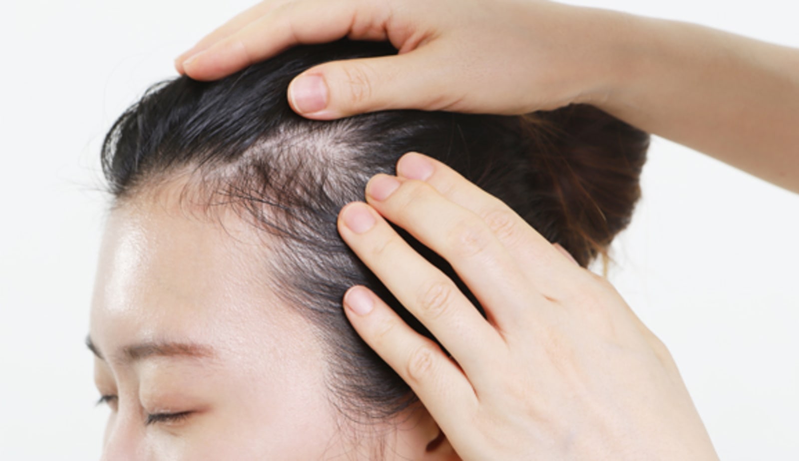 A doctor checks a patient's scalp for skin cancer