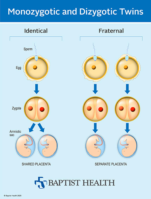 infographic depicting the difference between monozygotic and dizygotic twins