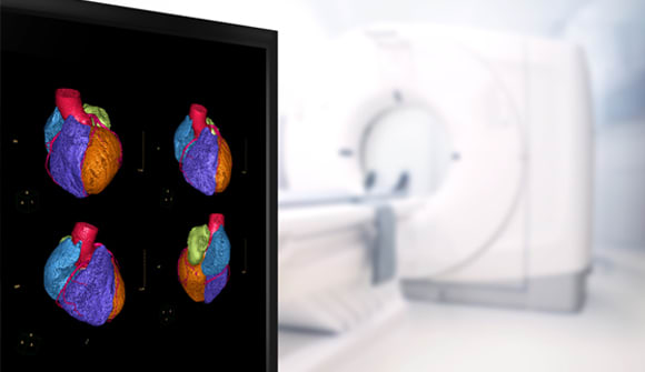 photo for Health in a heartbeat article