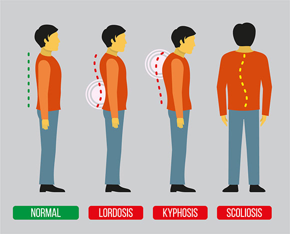 graphic showing different spine conditions