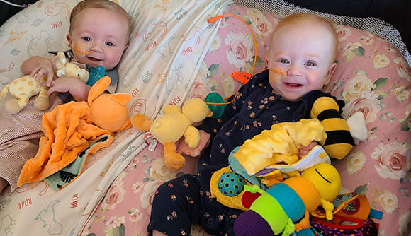 twins with heart defects