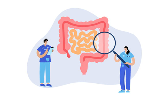 Graphic of the human colon