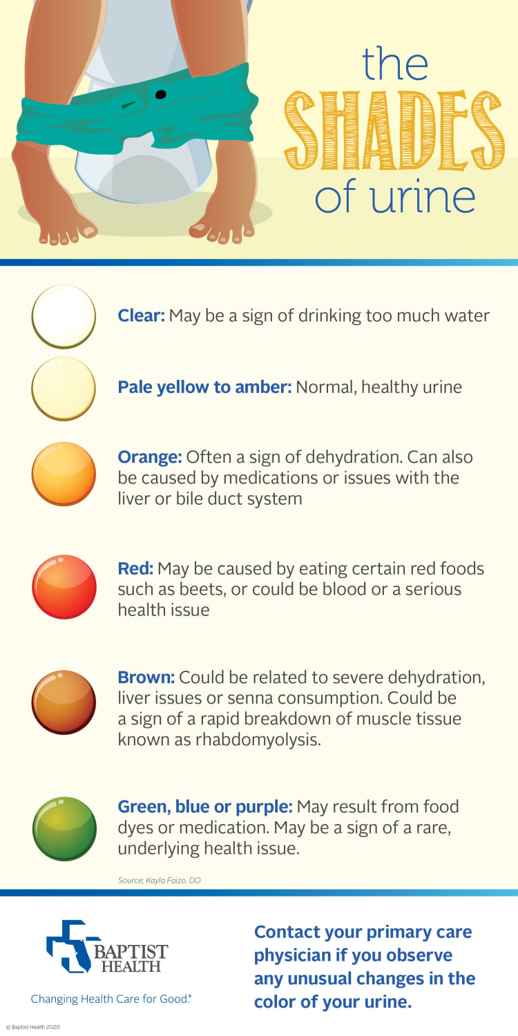 infographic detailing the different shades of urine and what they mean