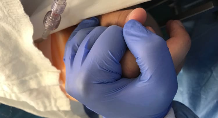 brain tumor patient Bender Middlekauff holding hand of nurse during awake brain surgery