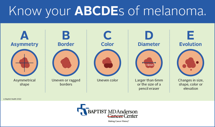 infographic depicting the ABCDEs of melanoma