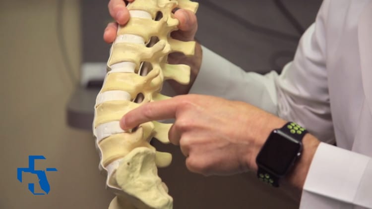 Doctor holding model of lower portion of lumbar spine, discs and nerves