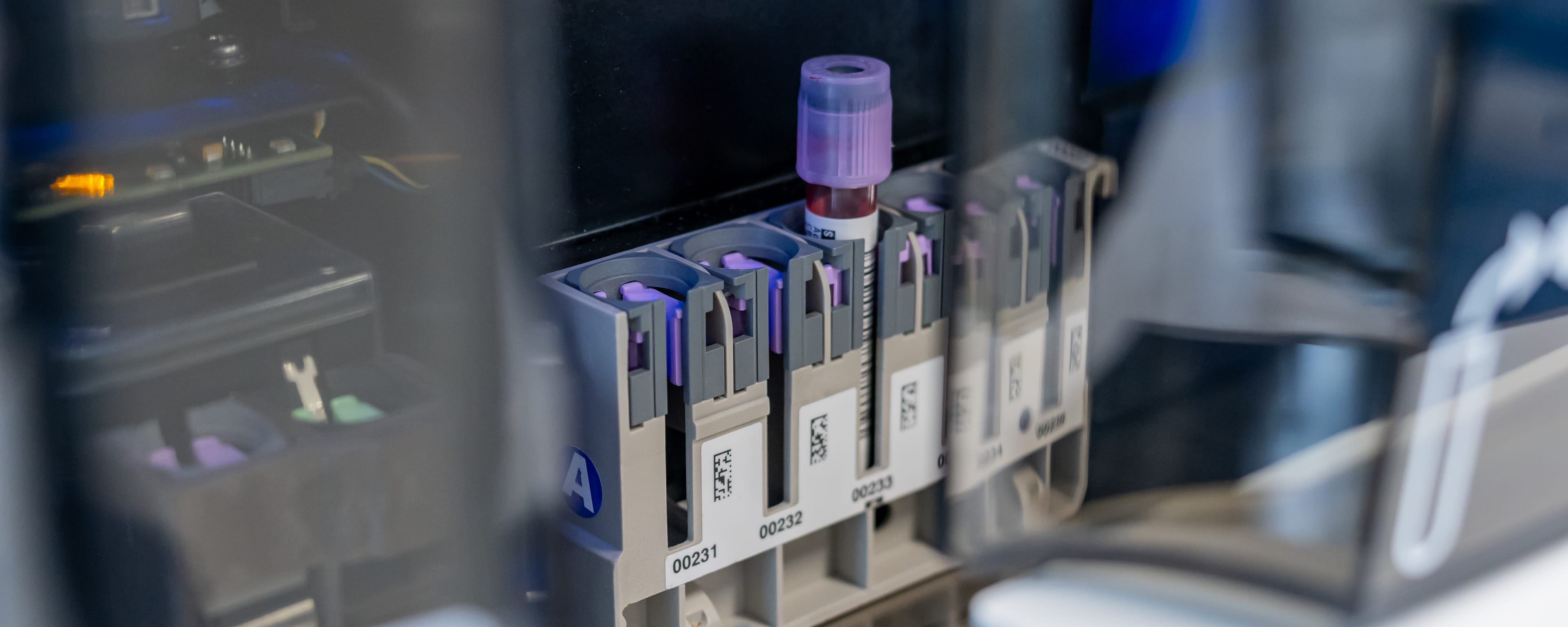 A vial of blood in a canister is ready for analysis by a pathologist at Baptist Health.