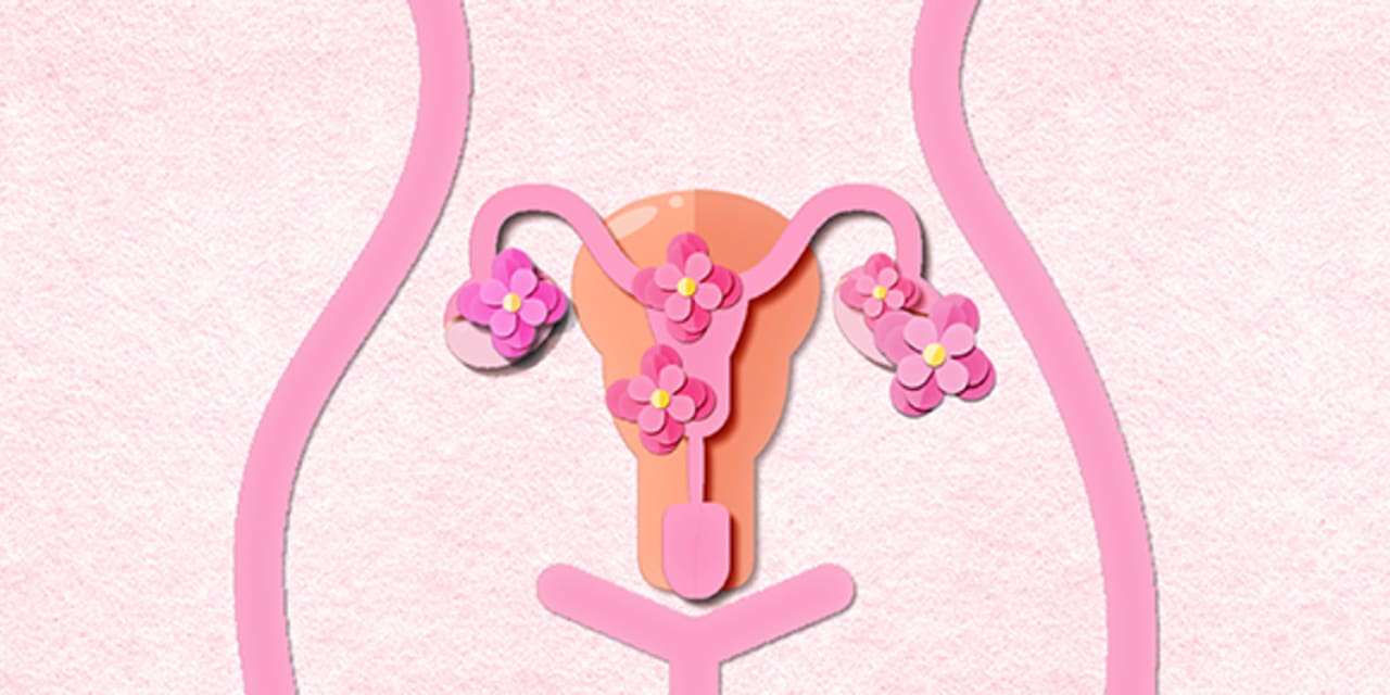 paper cut out depicting polycystic ovary syndrome