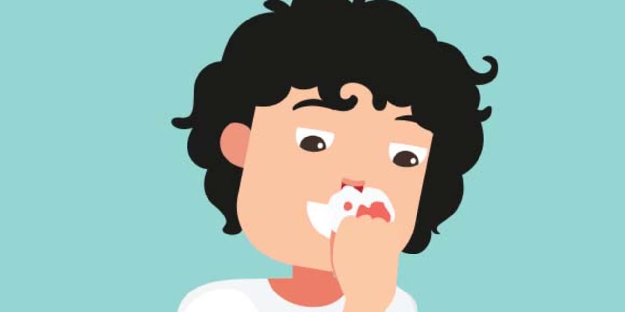photo for Nosebleed know-how article