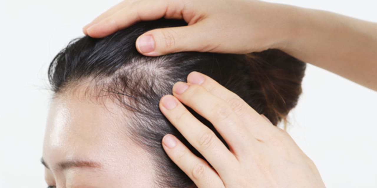 A doctor checks a patient's scalp for skin cancer