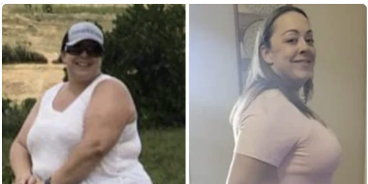 left side of photo shows an overweight woman smiling on a horse, and the right side of the photo shows her after losing a lot of weight after finding a long-term weight loss solution in bariatric surgery.