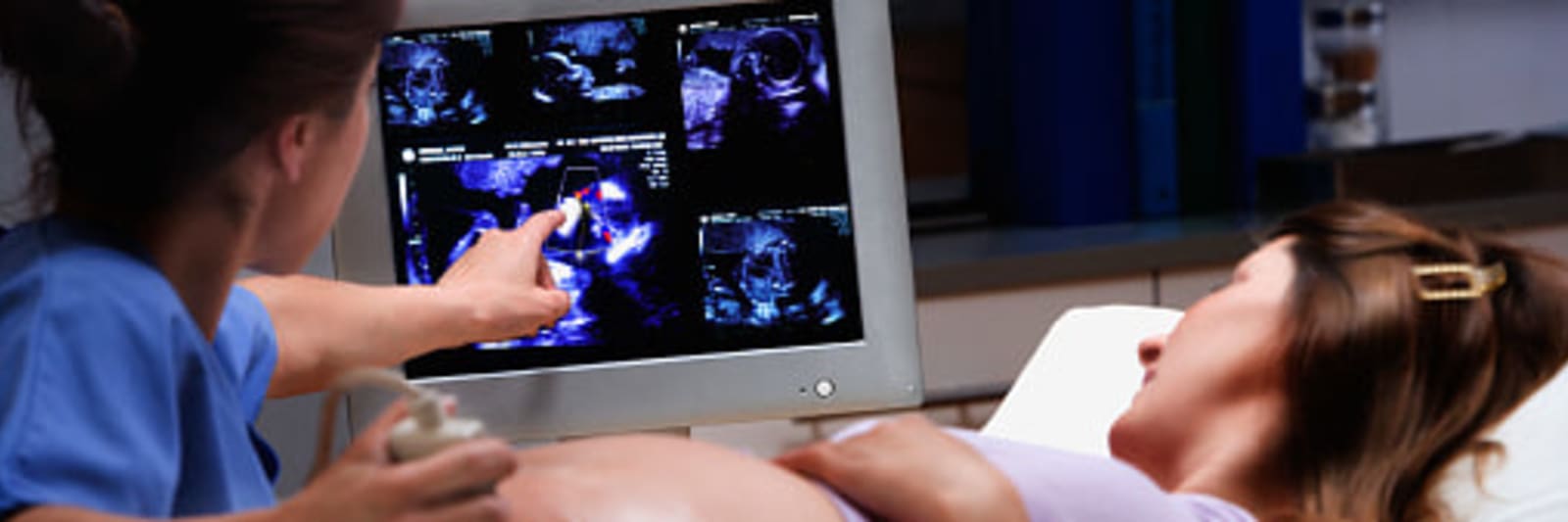 a technician is performing an ultrasound on a pregnant woman and points out something to the patient on the monitor