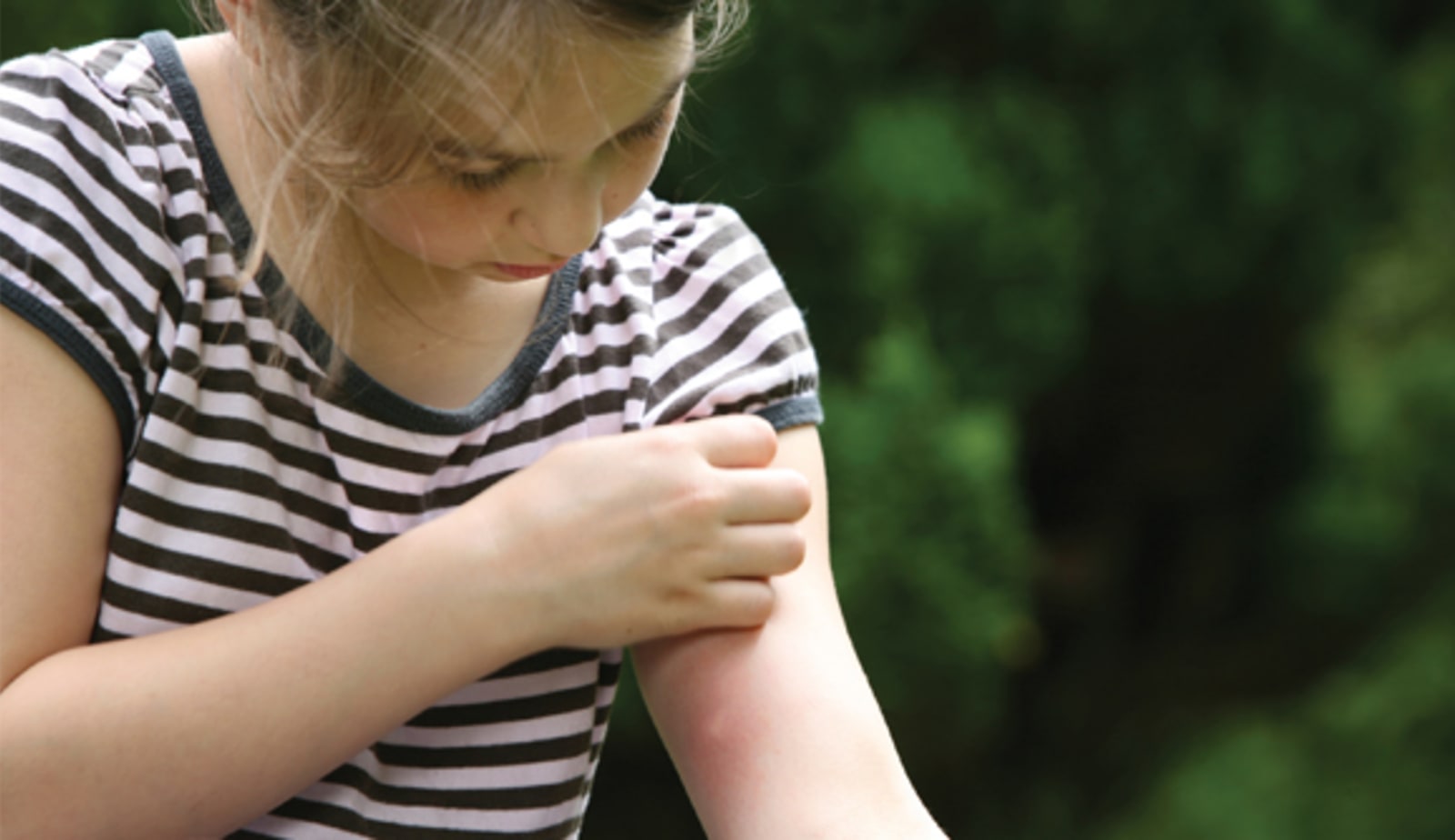 child scratching arm