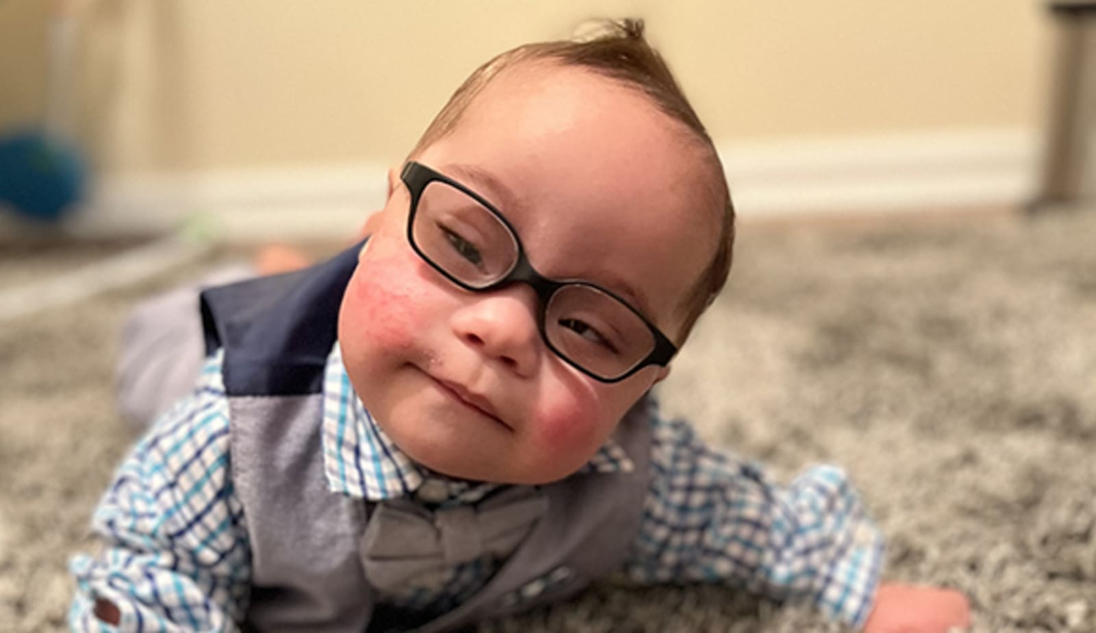 Neonatal surgery patient Malachi