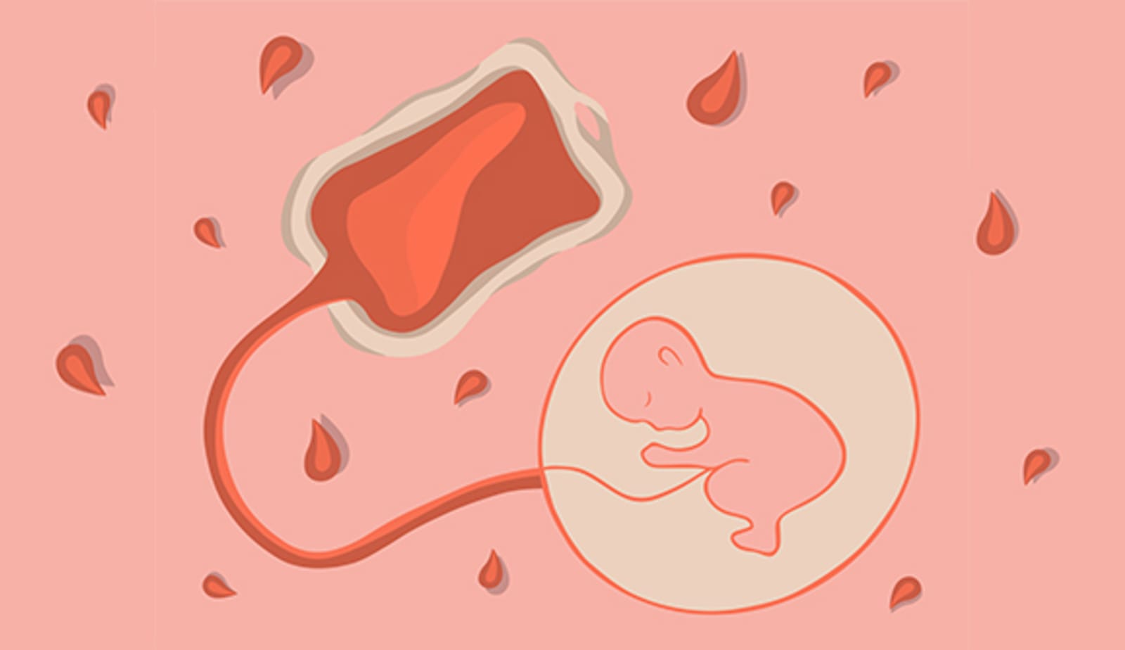 depiction of a baby in a womb attached to a blood bag