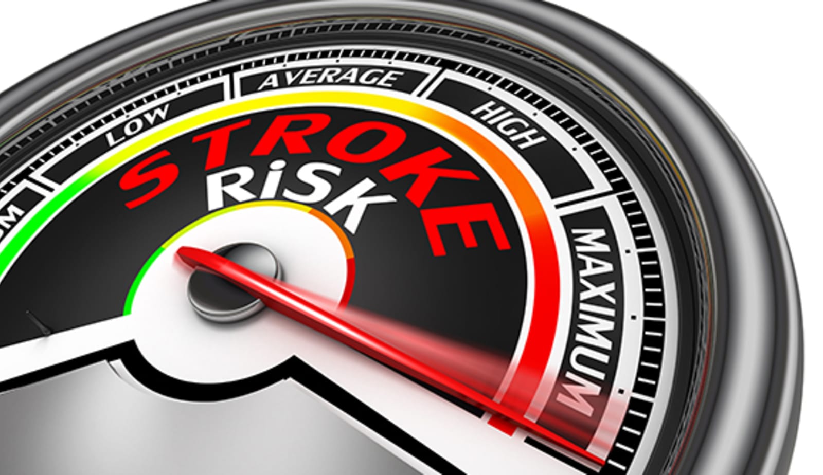 photo for Do you know your stroke risk? article