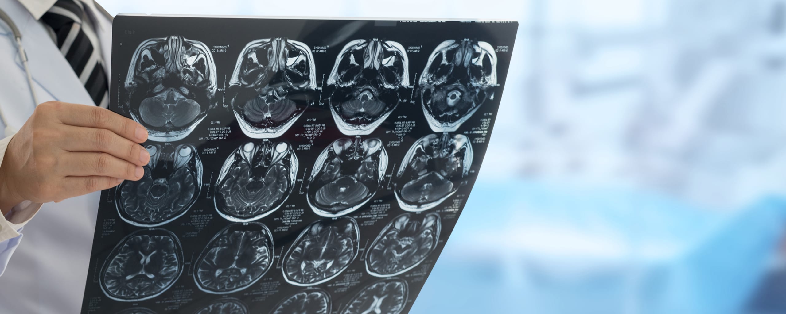 Photo of a male doctor reviewing a scan of the brain in a hospital setting